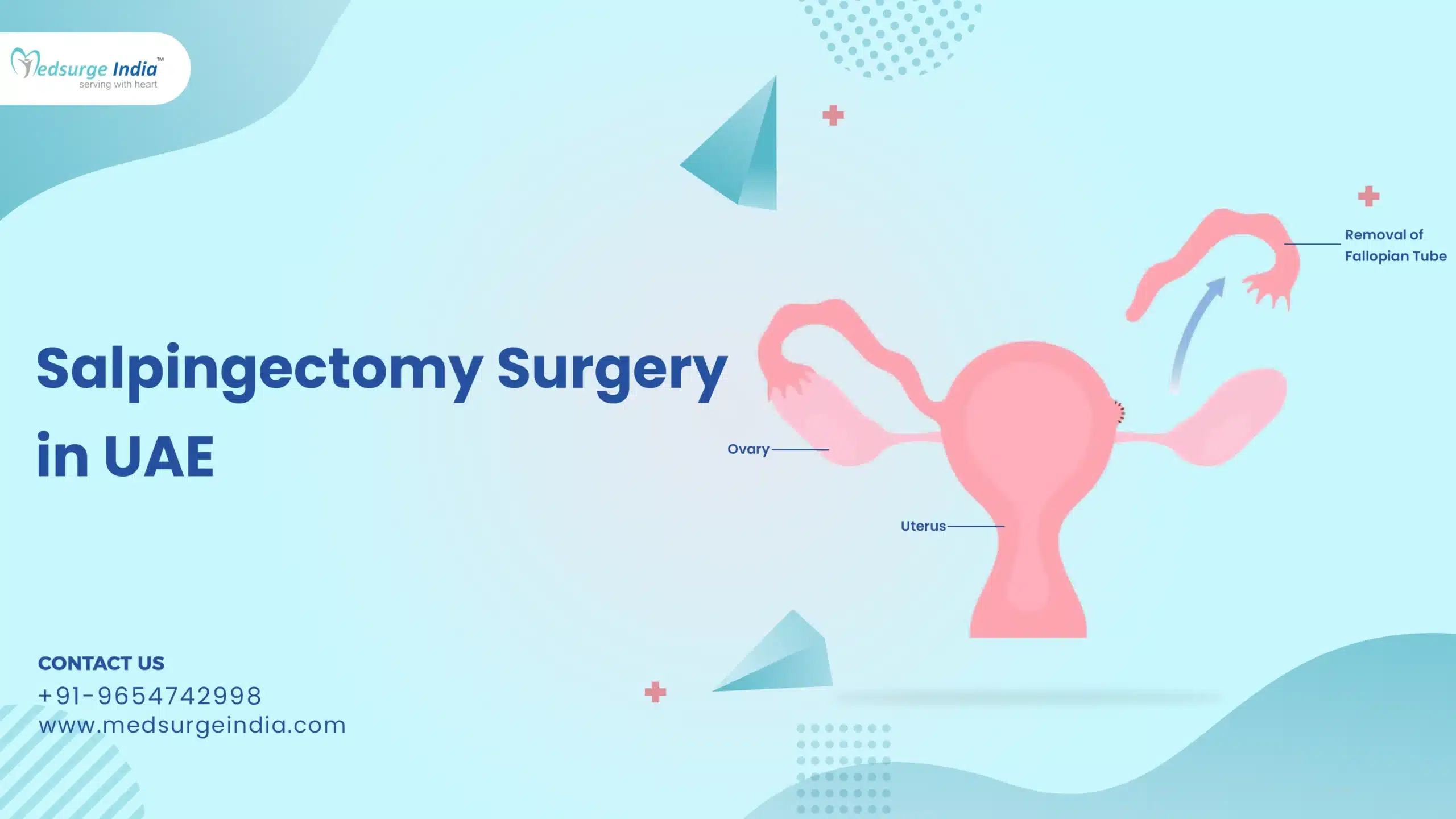 Salpingectomy Surgery Cost In UAE