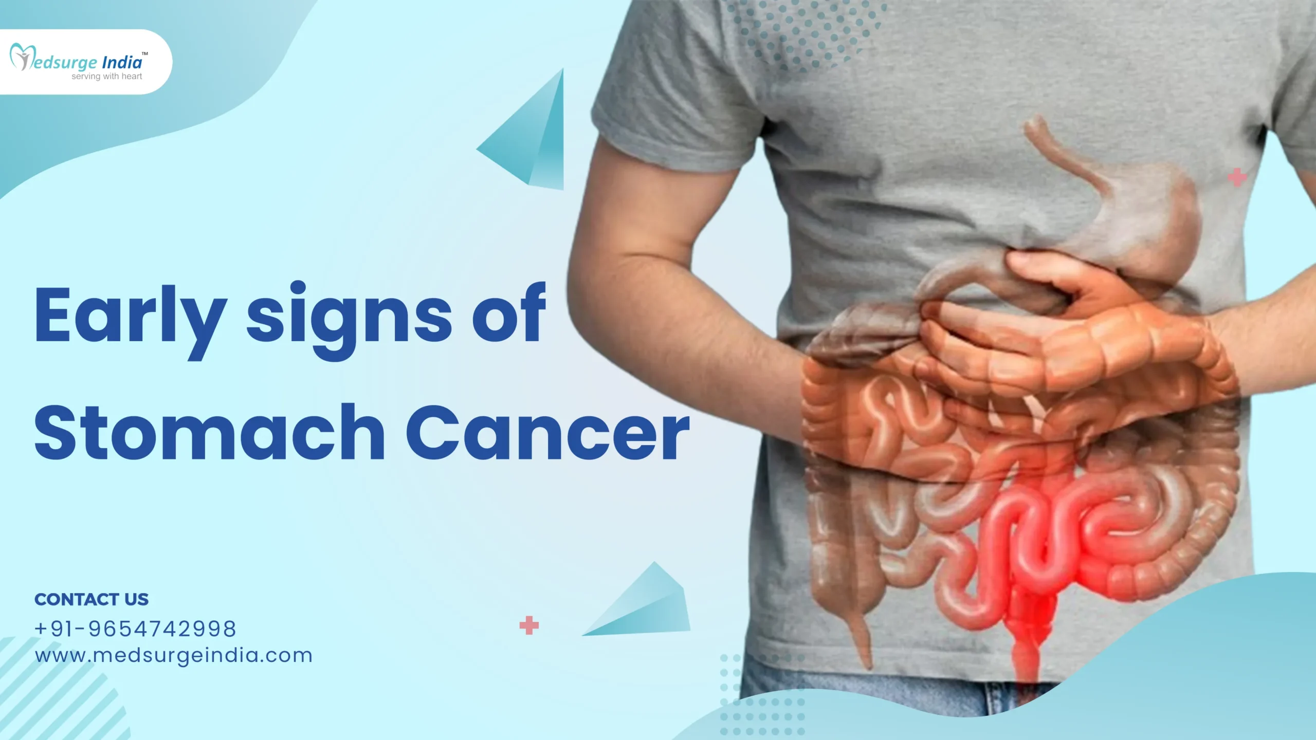 Signs of stomach cancer