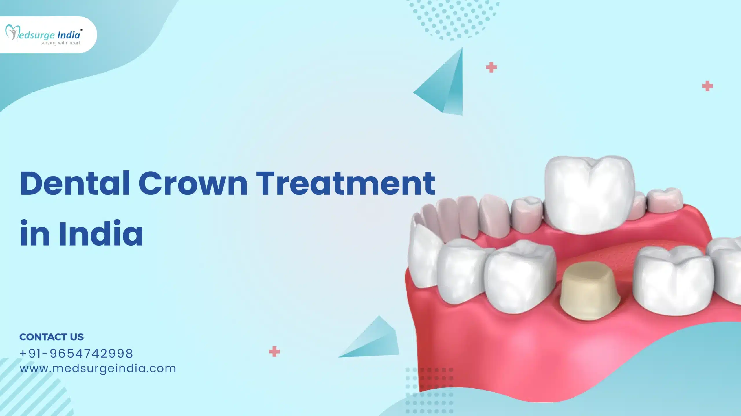 Dental Crown Treatment Cost in India