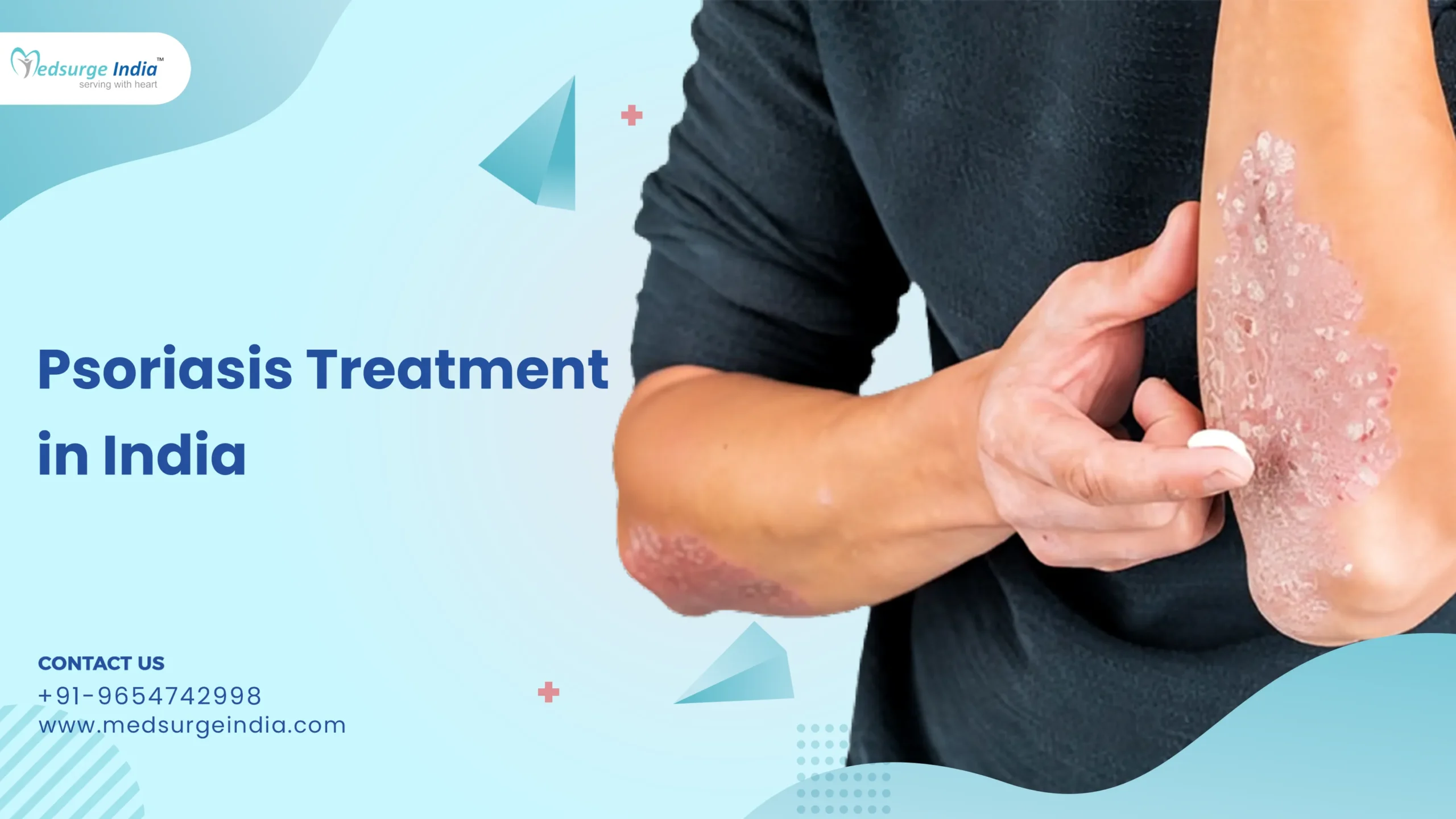 Psoriasis Treatment Cost in India