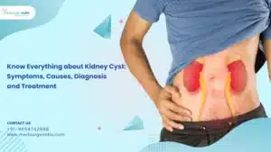 Kidney Cyst