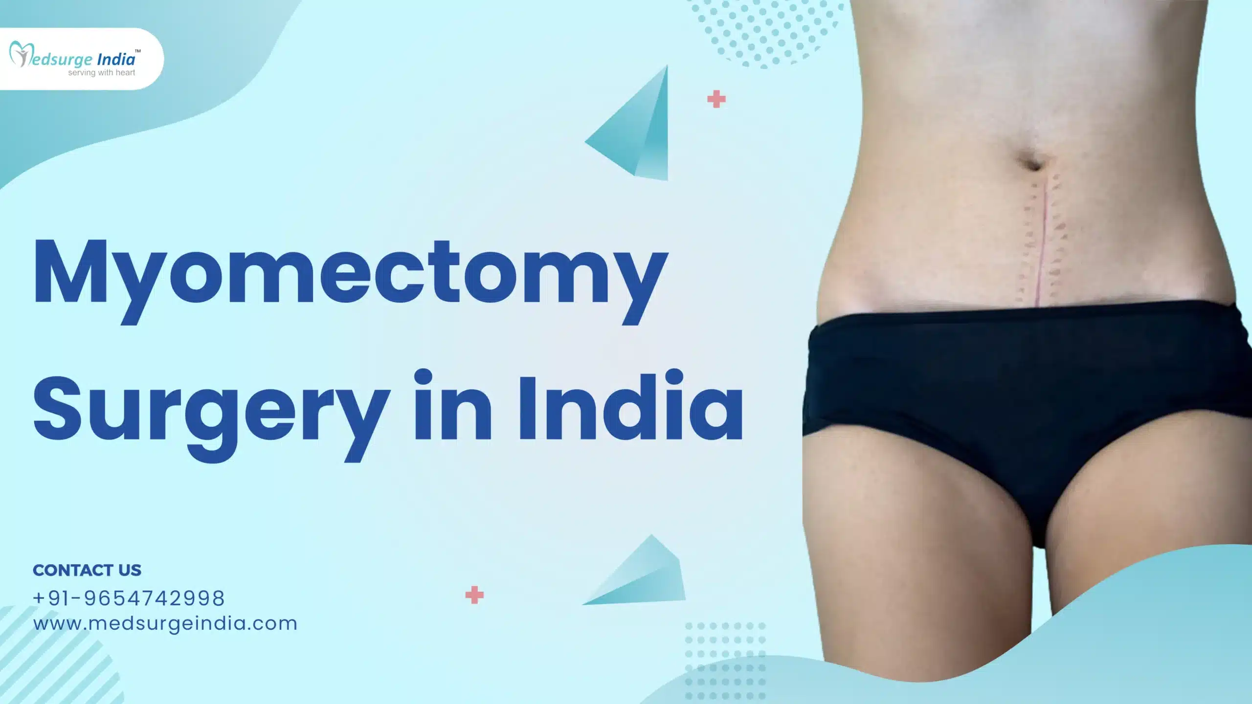 Myomectomy Surgery Cost in India