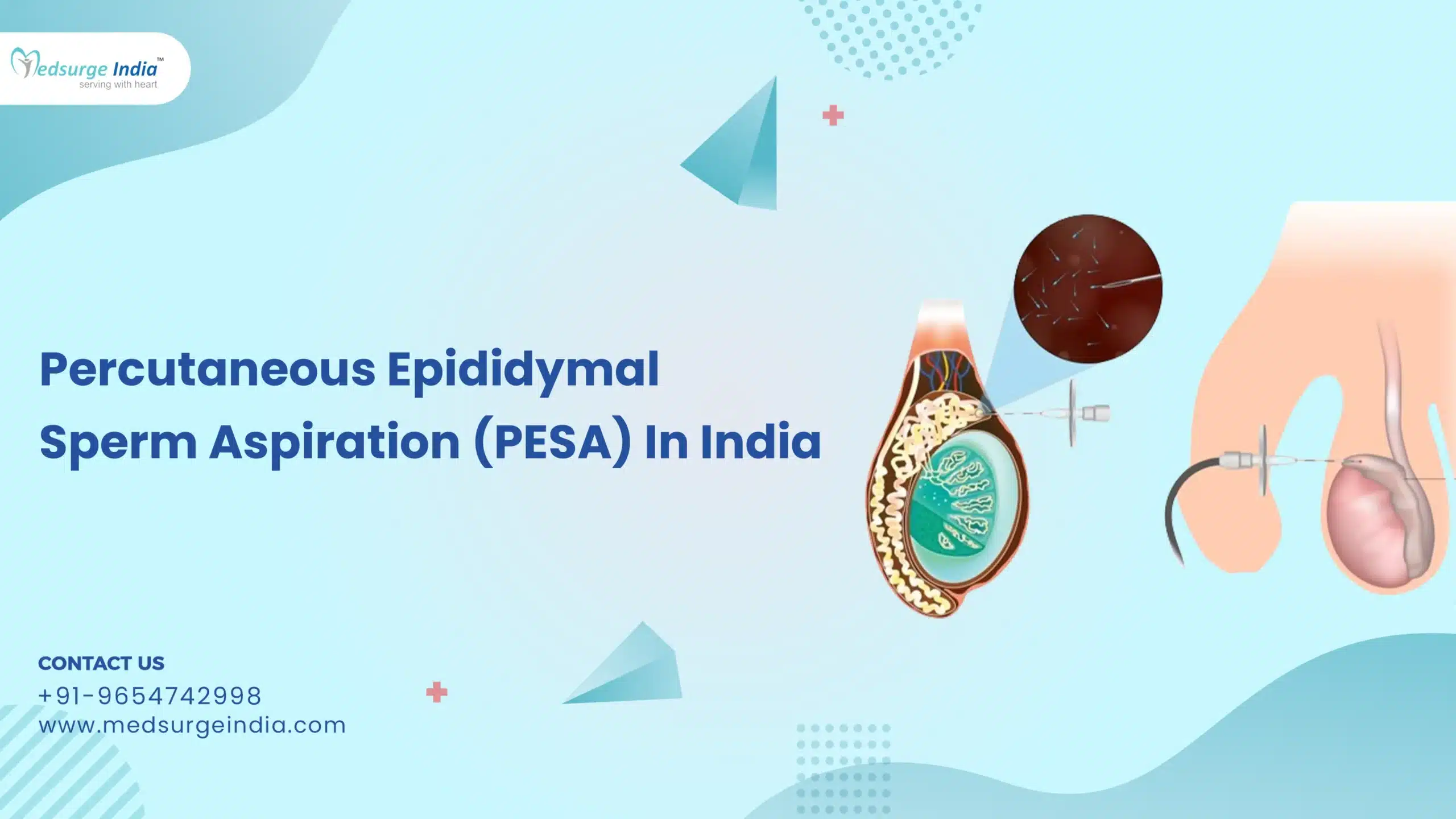 Percutaneous Epididymal Sperm Aspiration (PESA) Cost In India