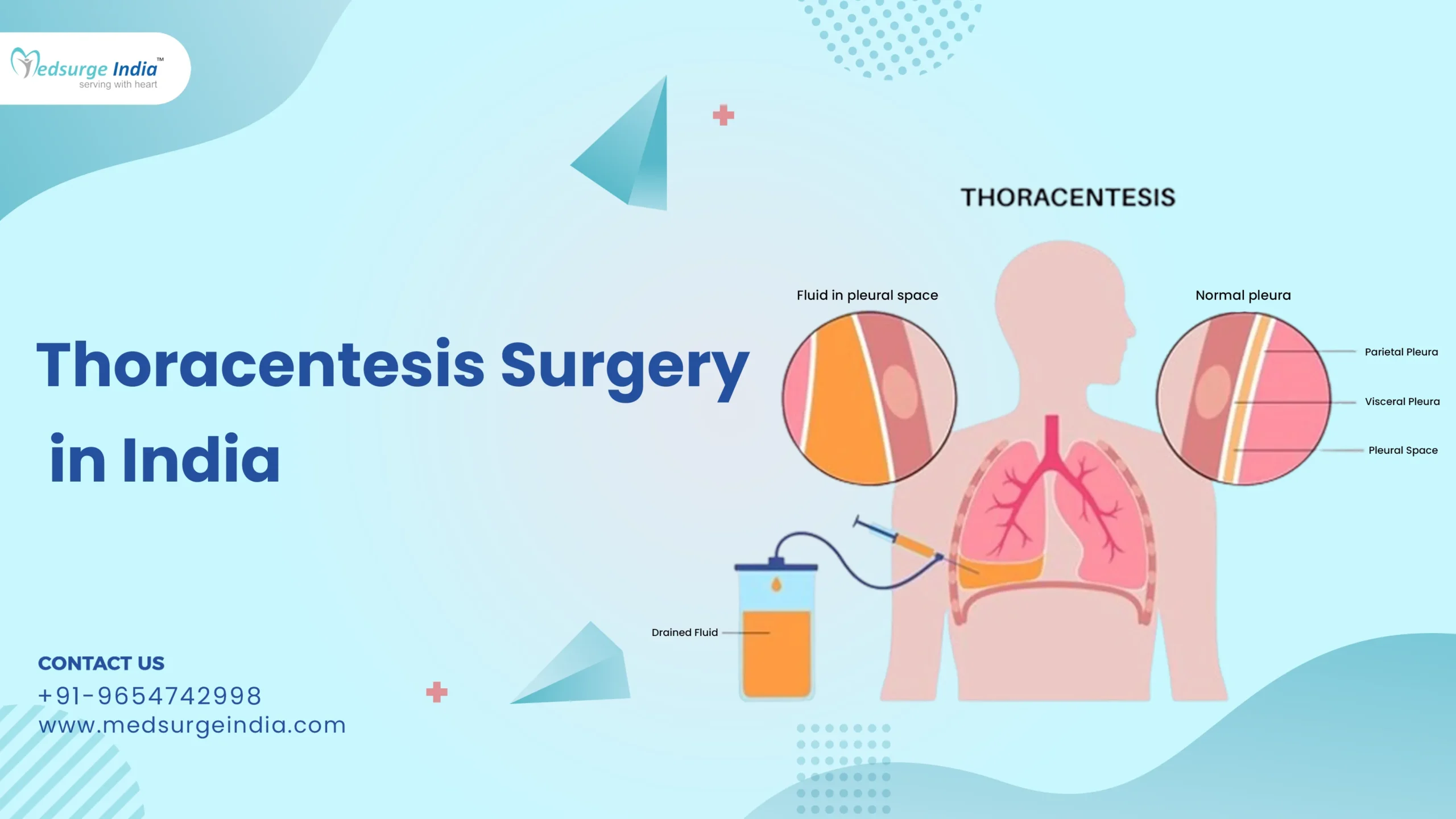 Thoracentesis Cost in India