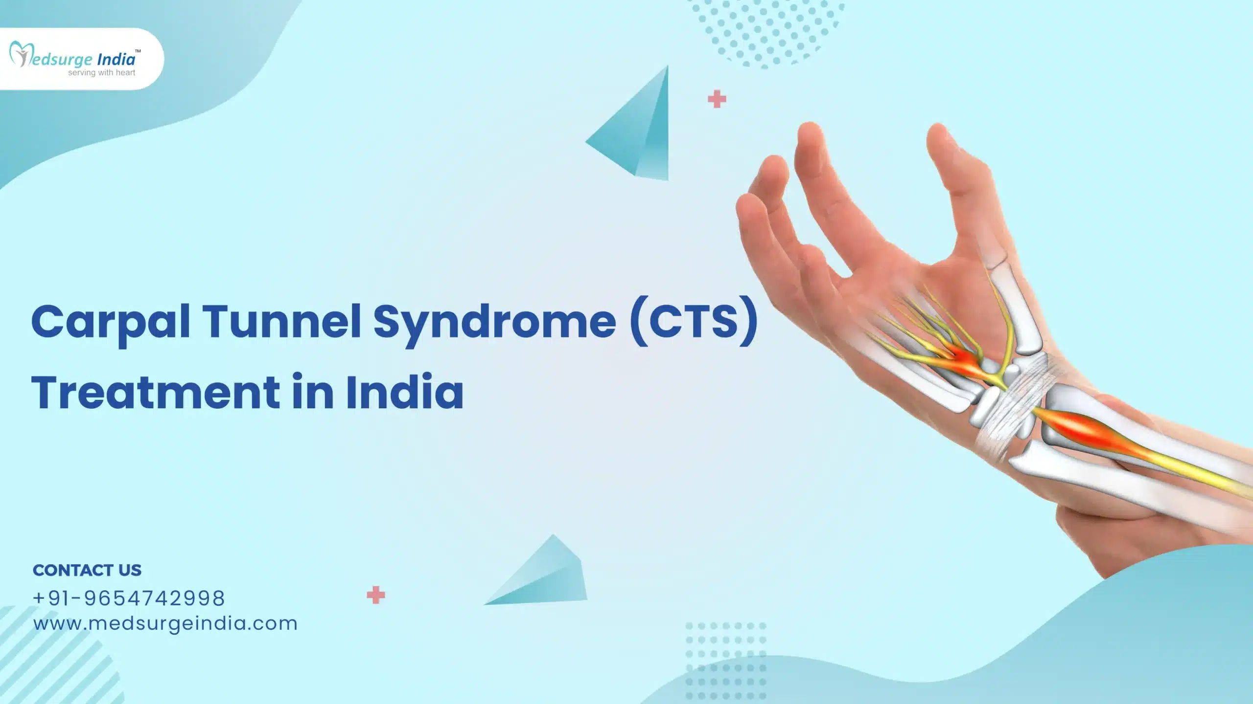 Carpal Tunnel Syndrome Treatment Cost in India