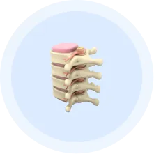 Spine Surgery