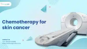 chemotherapy for skin cancer