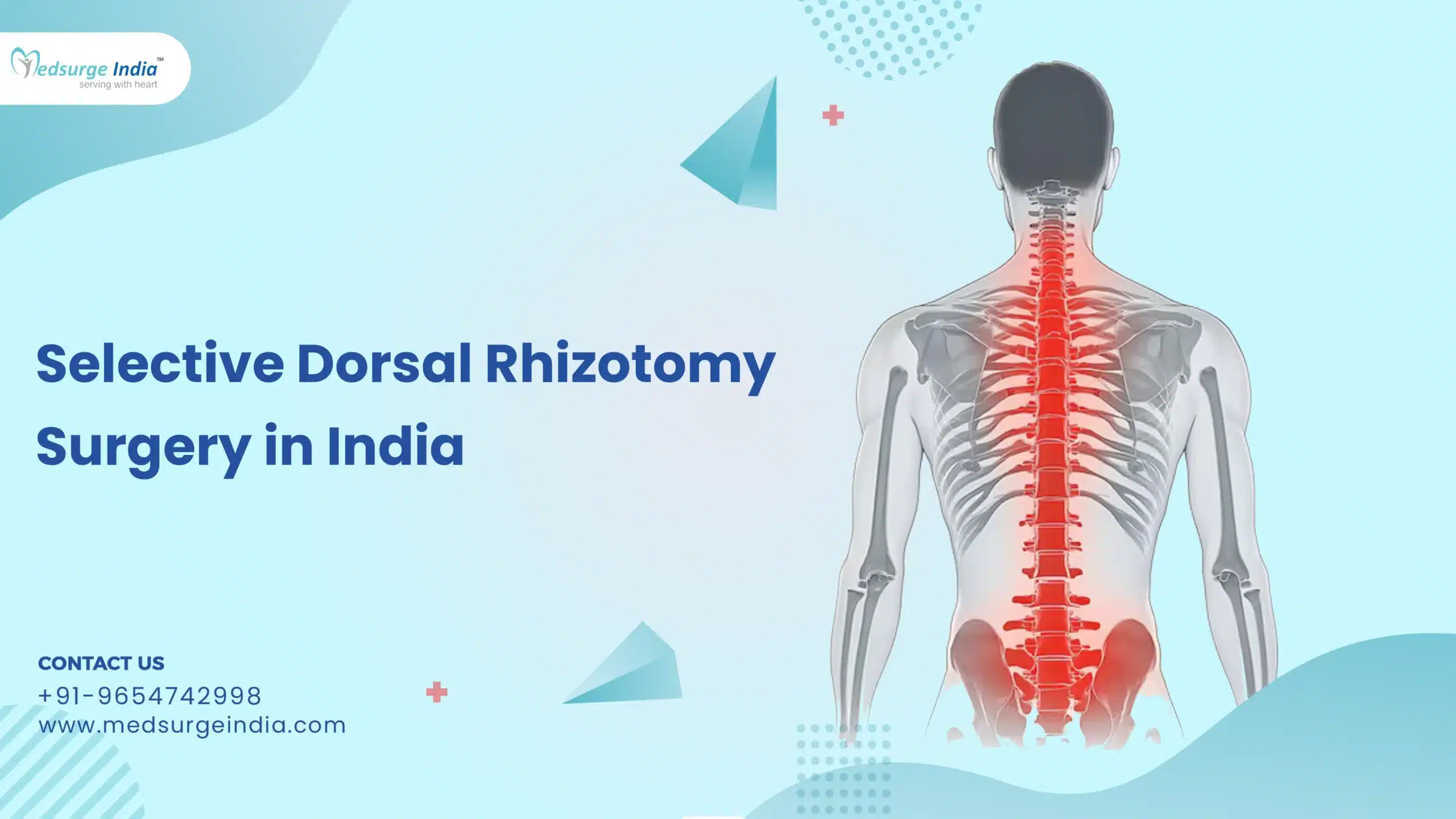 Selective Dorsal Rhizotomy Surgery Cost in India