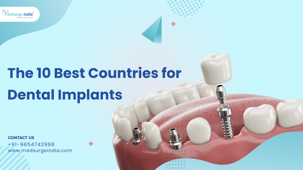 Best Countries For Dental Implants