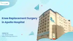 Knee Replacement Surgery Cost in Apollo Hospital