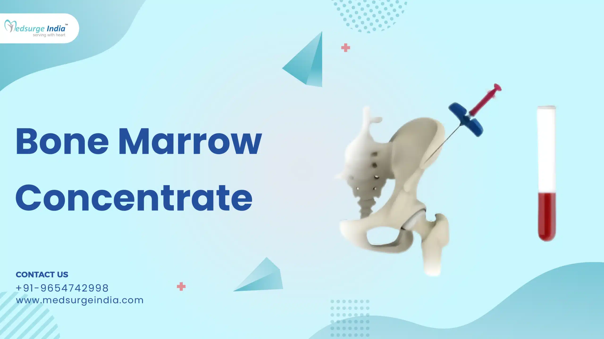 Bone Marrow Concentrate (BMC)