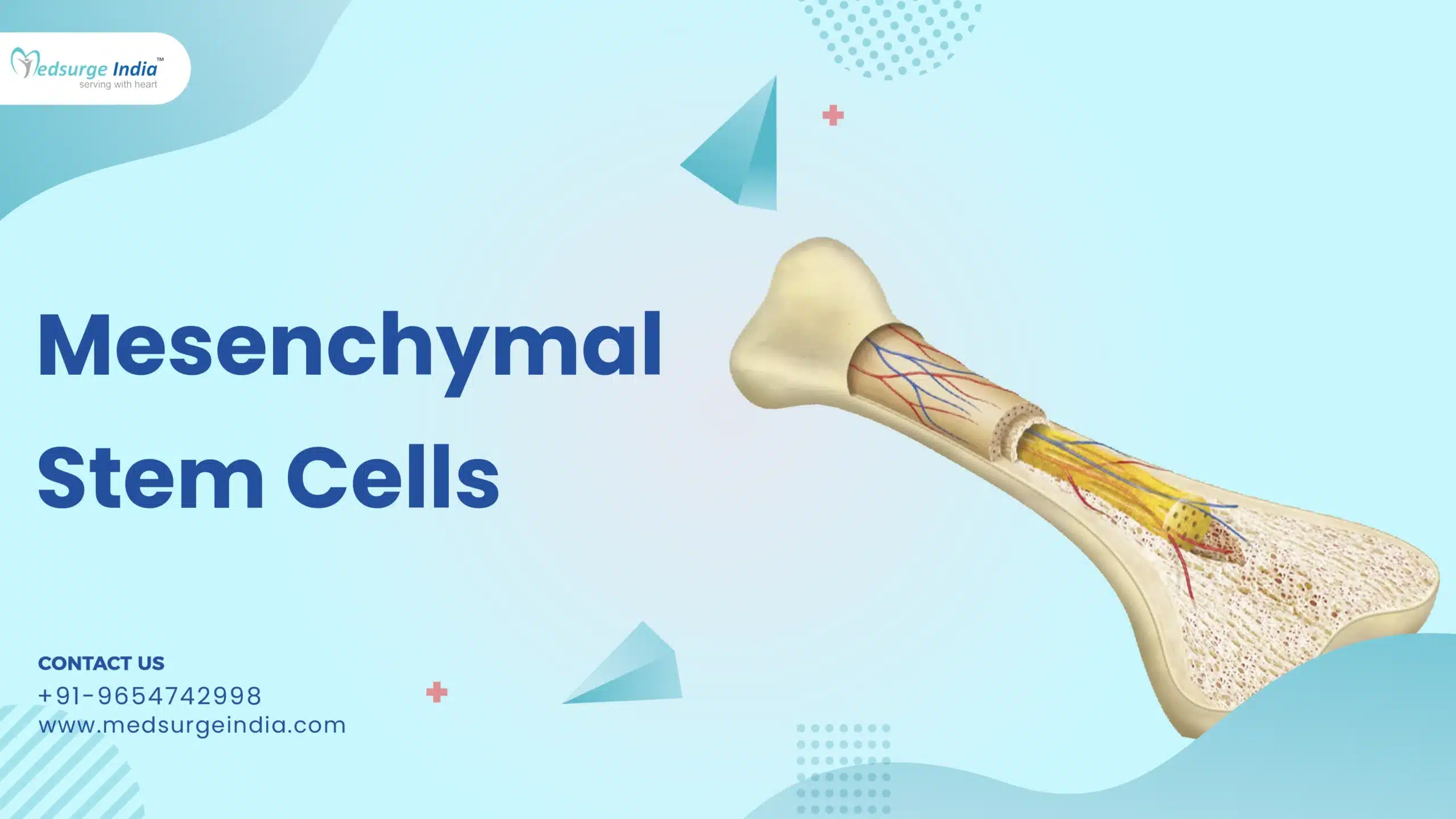 Mesenchymal Stem Cells (MSCs)