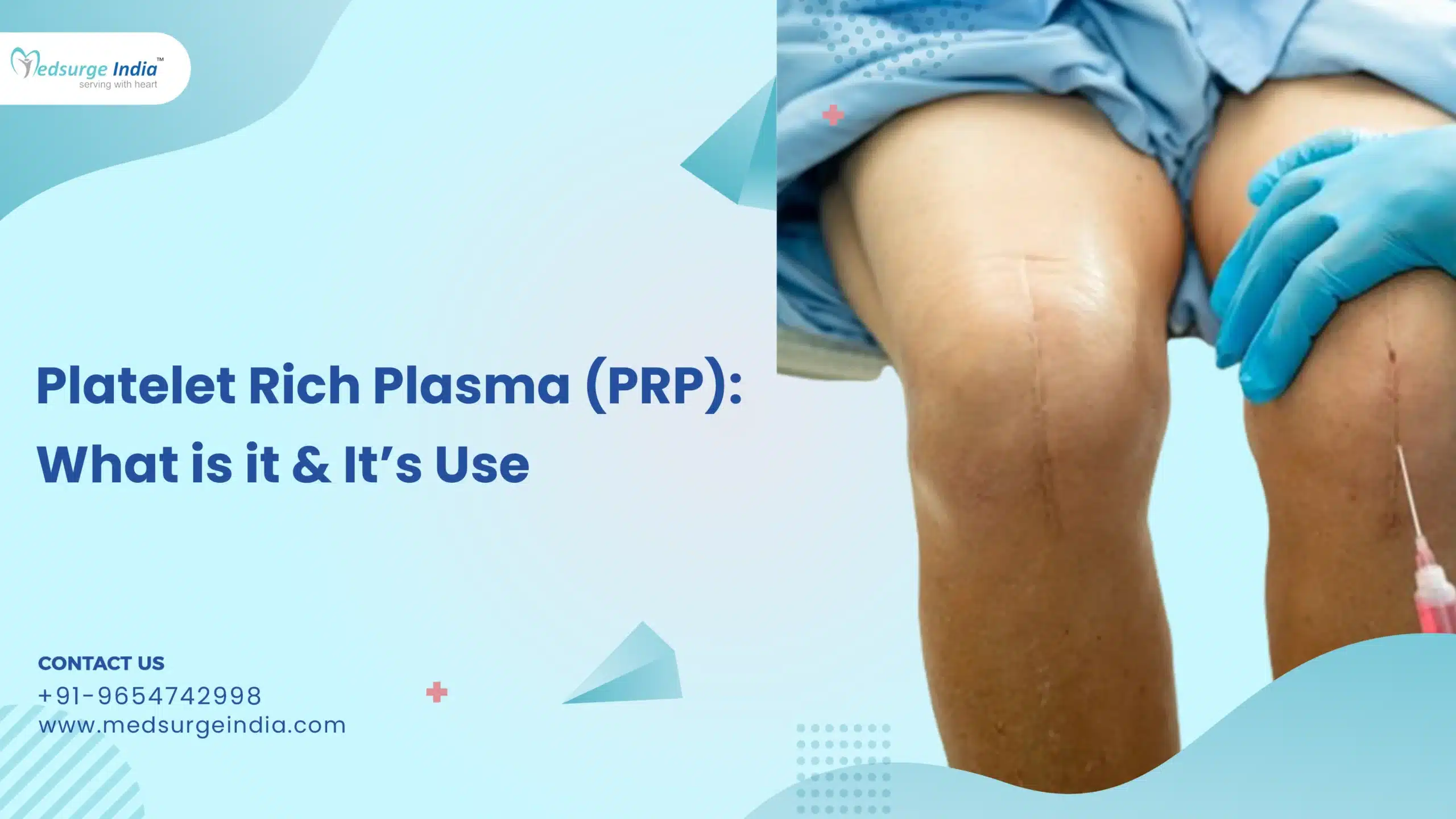 Platelet Rich Plasma (PRP): What is it & It’s Use