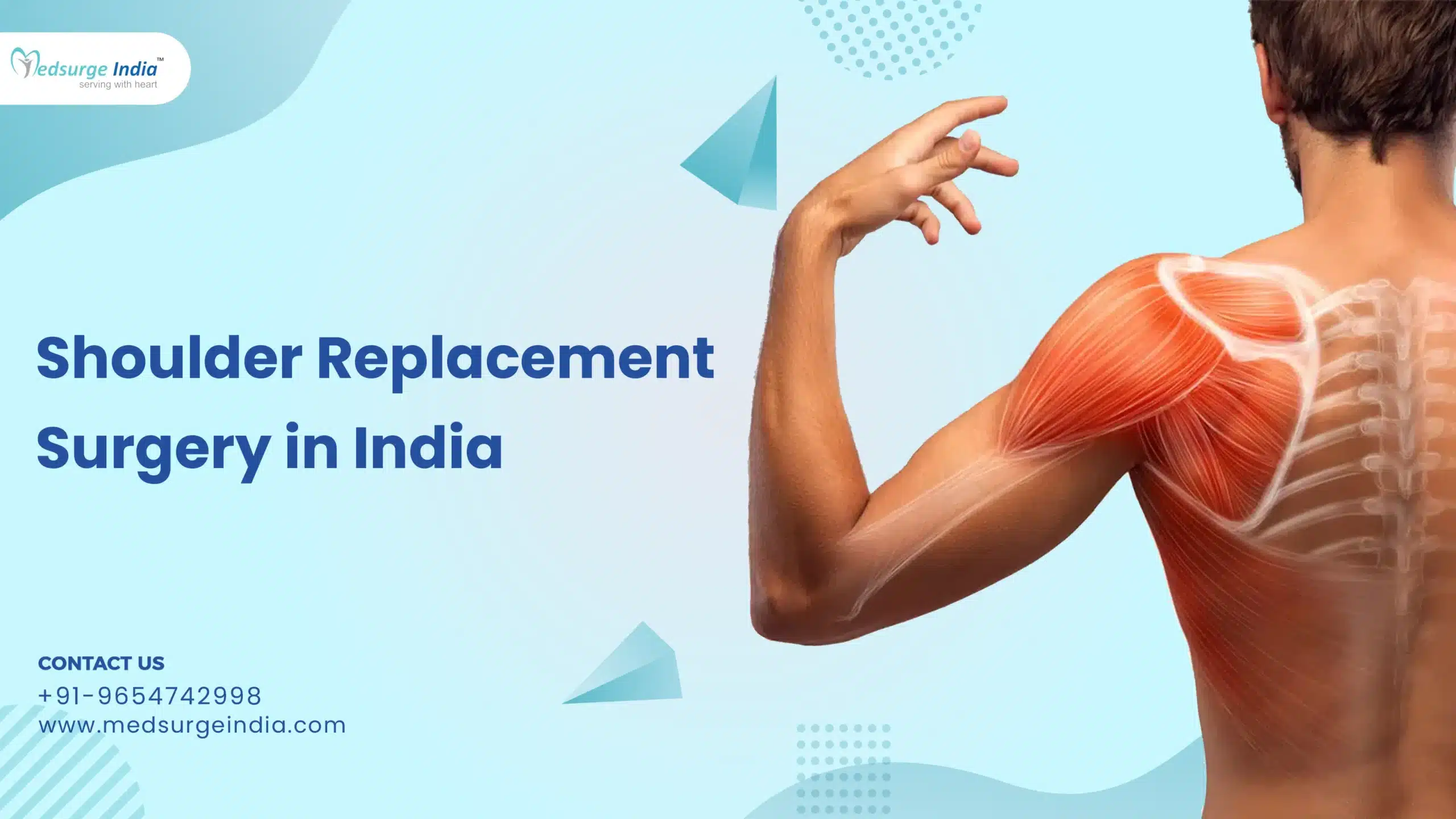 Shoulder Replacement Surgery in India