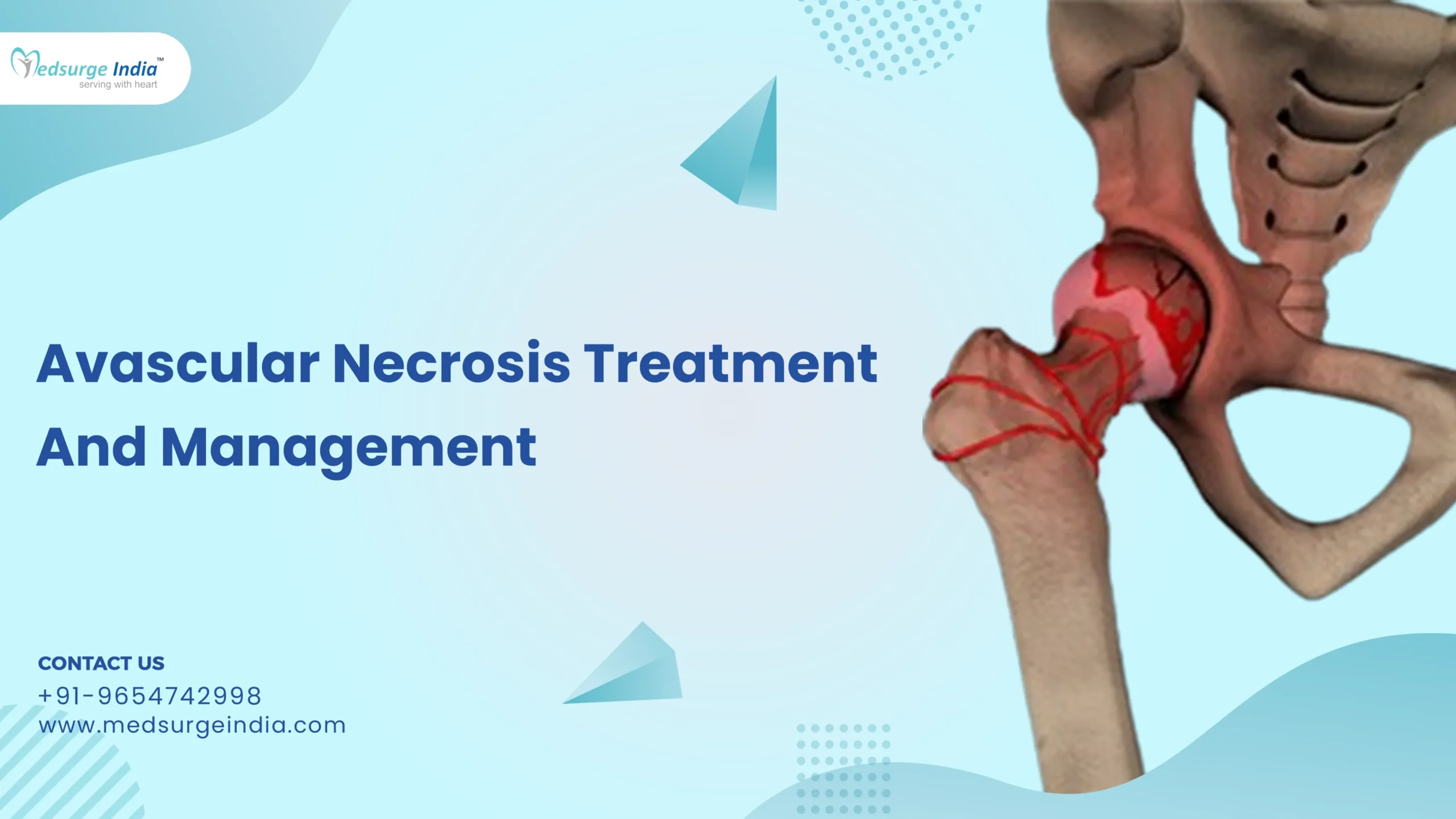 Avascular Necrosis Treatment And Management