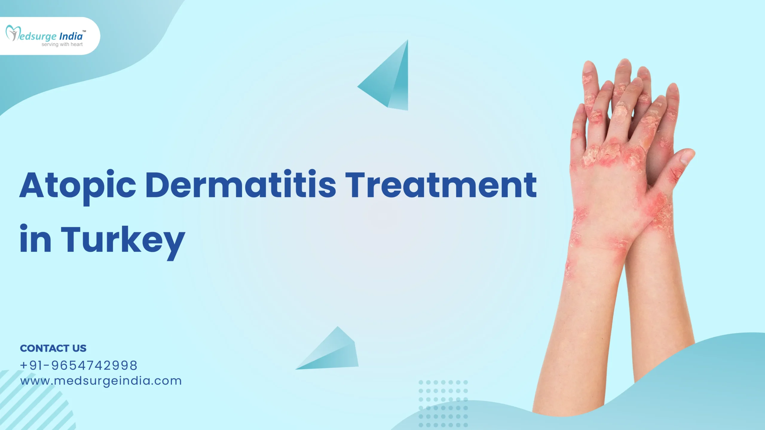 Atopic Dermatitis Treatment Cost in Turkey