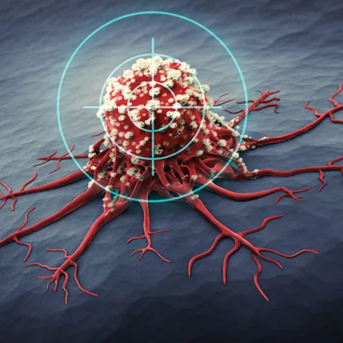 Targeted Therapy 