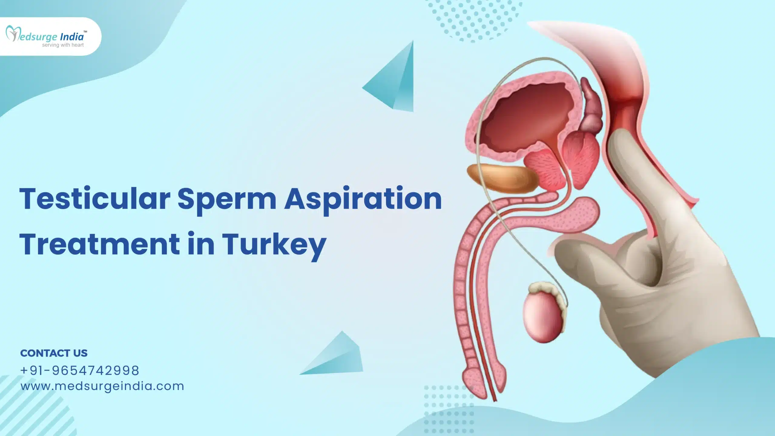 Testicular Sperm Aspiration Treatment Cost in Turkey