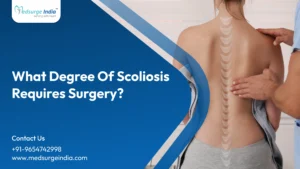 What Degree of Scoliosis Requires Surgery