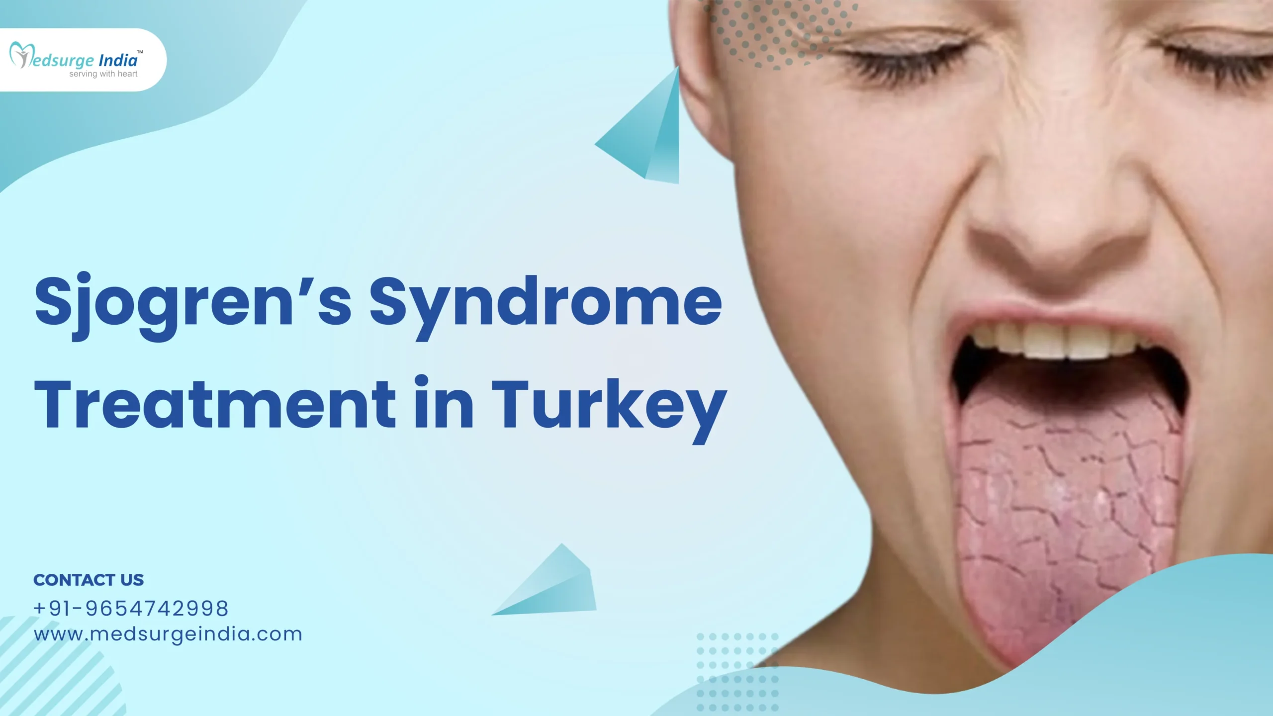 Sjogren’s Syndrome Treatment Cost in Turkey
