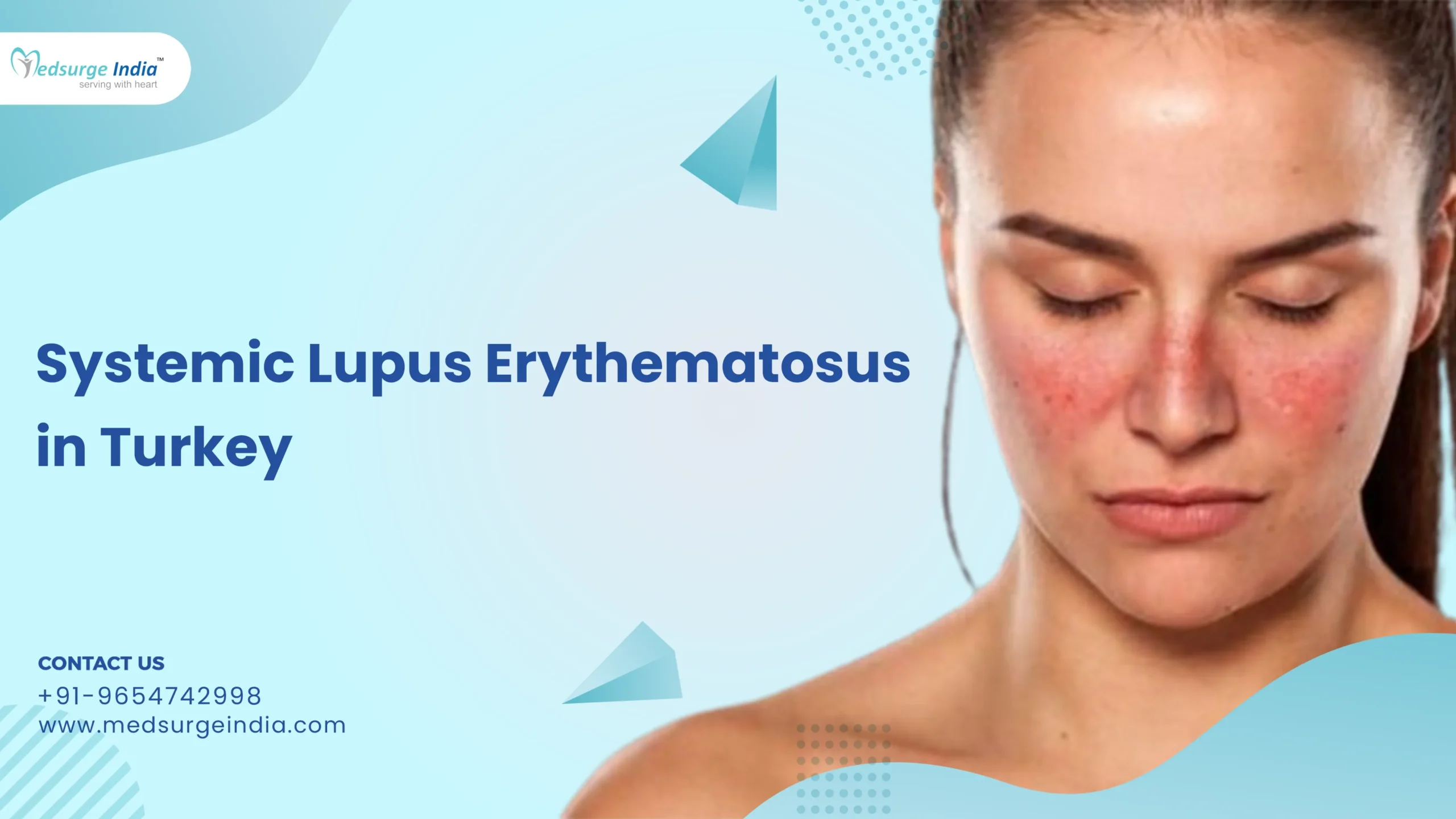 Systemic Lupus Erythematosus Cost in Turkey