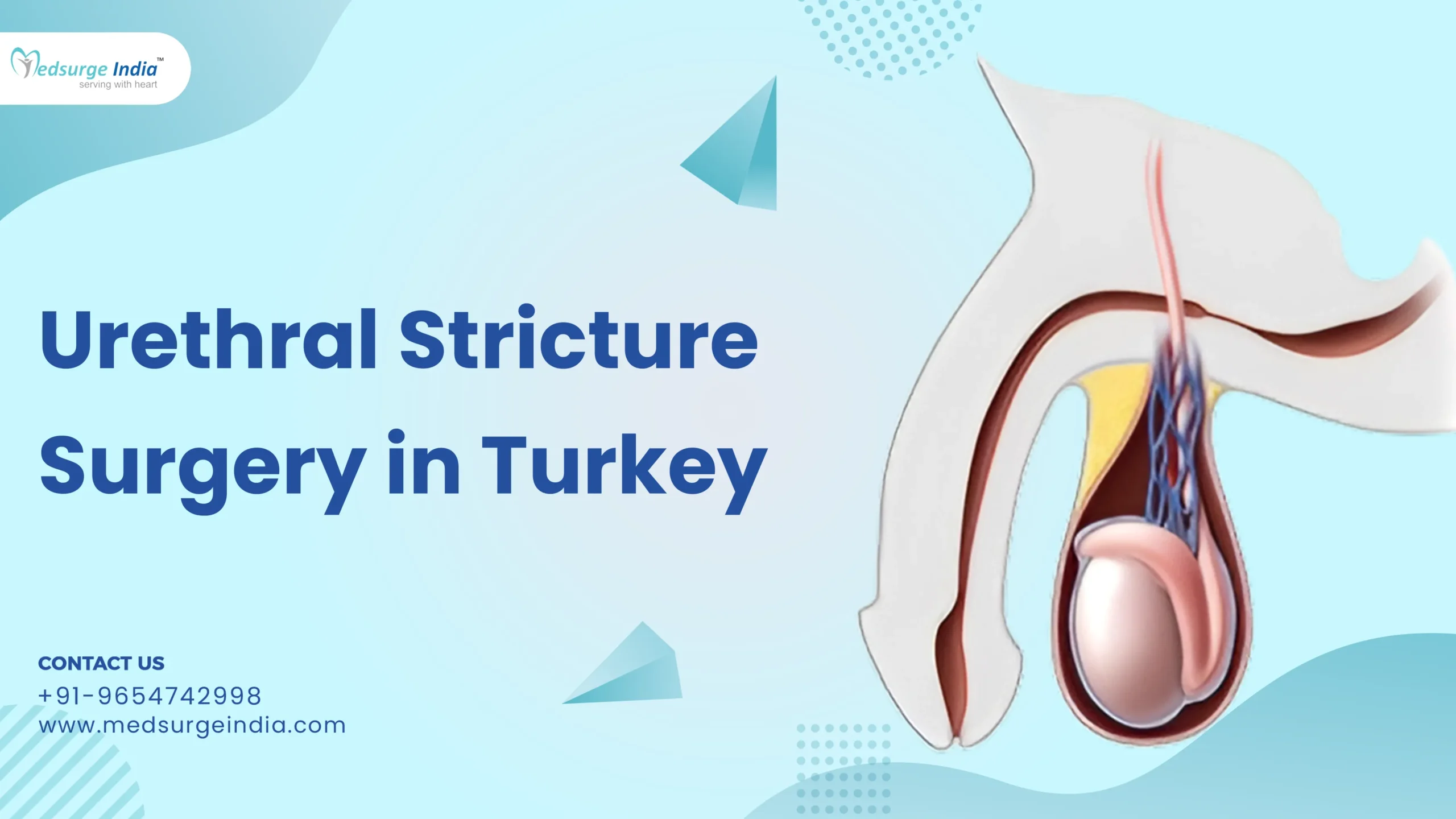 Urethral Stricture Surgery Cost in Turkey