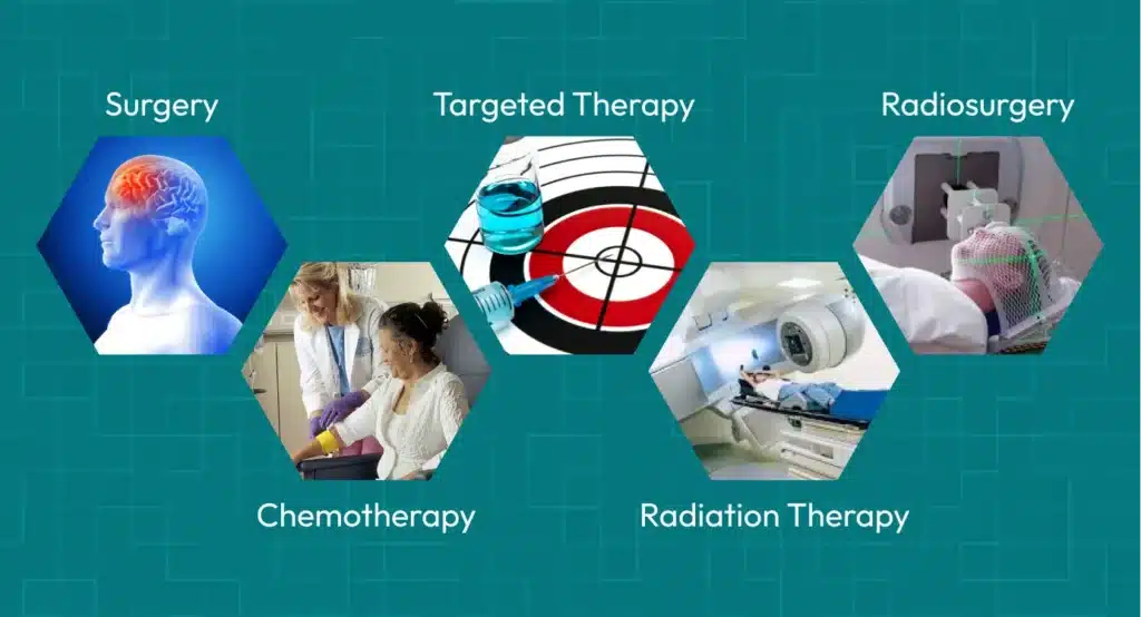 Brain tumor treatment