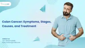 Colon Cancer: Symptoms, Stages, Causes, and Treatment Colon Cancer