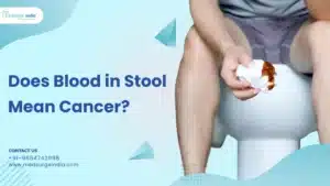 Does Blood in Stool Mean Cancer