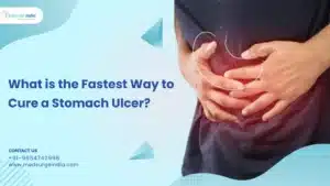 cure a Stomach Ulcer
