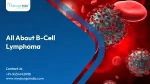 B-Cell Lymphoma