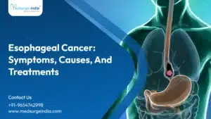 Esophageal Cancer