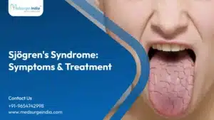 Sjögren's Syndrome