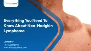 Non-Hodgkin Lymphoma