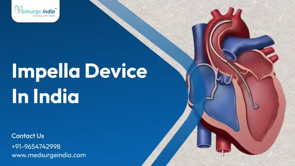 Impella Device Cost in India