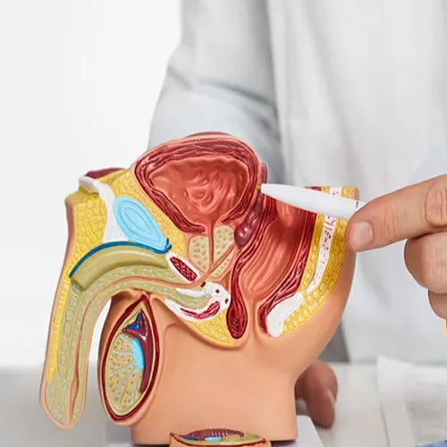 Male Infertility Treatment